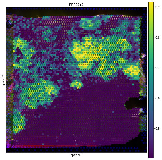 ../_images/tutorials_denoising_and_regulon_inference_28_0.png