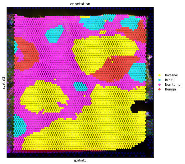 ../_images/tutorials_invasive_ductal_carcinoma_21_0.png