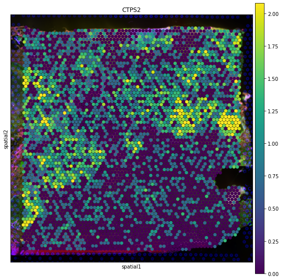 ../_images/tutorials_denoising_and_regulon_inference_10_0.png