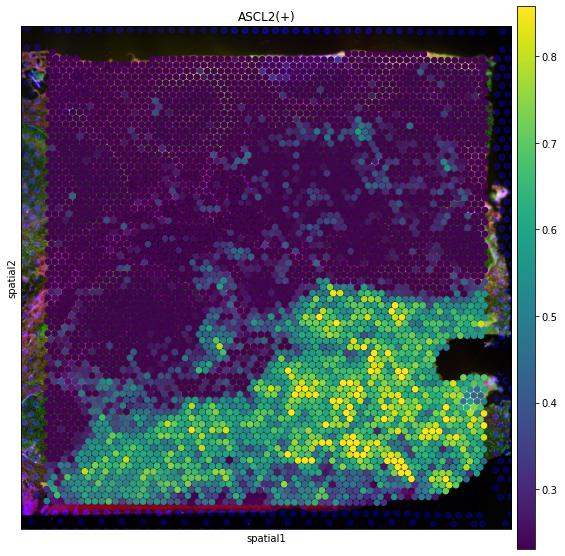 ../_images/tutorials_denoising_and_regulon_inference_26_0.png
