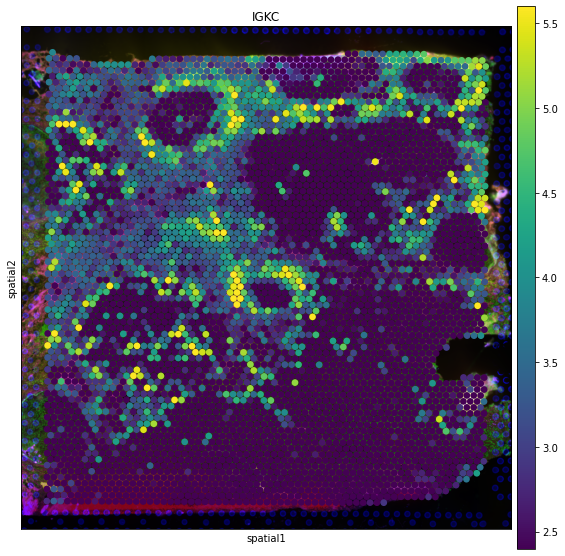../_images/tutorials_invasive_ductal_carcinoma_27_0.png