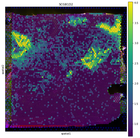 ../_images/tutorials_invasive_ductal_carcinoma_26_0.png